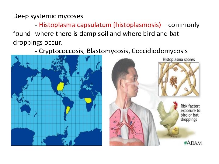 Deep systemic mycoses - Histoplasma capsulatum (histoplasmosis) – commonly found where there is damp