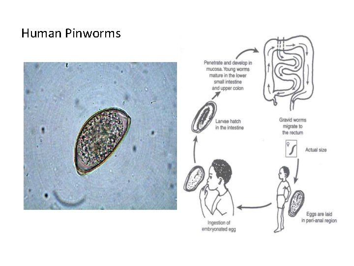 Human Pinworms 