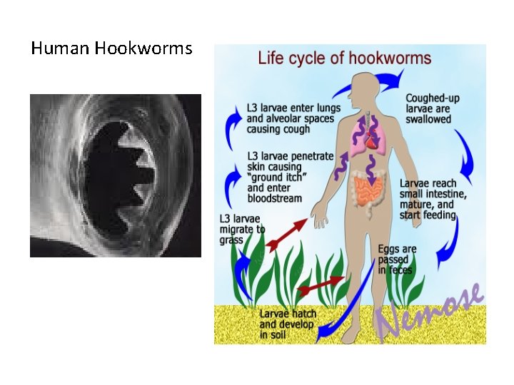 Human Hookworms 
