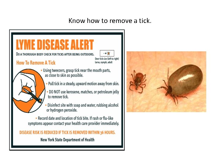 Know how to remove a tick. 