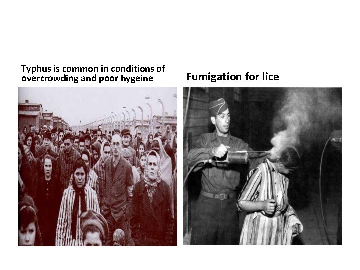 Typhus is common in conditions of overcrowding and poor hygeine Fumigation for lice 