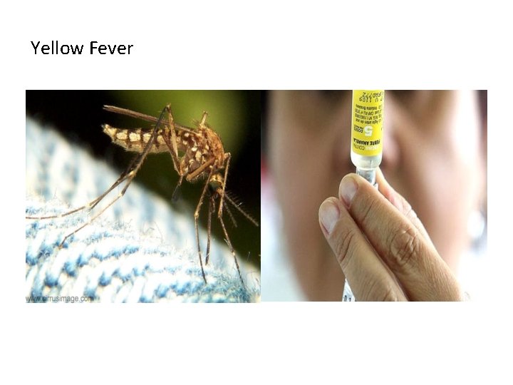 Yellow Fever 