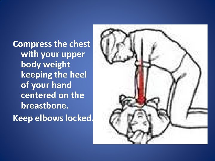 Compress the chest with your upper body weight keeping the heel of your hand