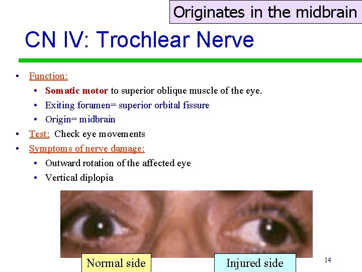 Originates in the midbrain CN IV: Trochlear Nerve • Function: • Somatic motor to