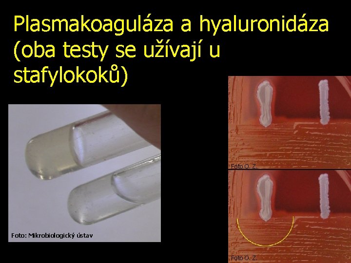 Plasmakoaguláza a hyaluronidáza (oba testy se užívají u stafylokoků) Foto O. Z. Foto: Mikrobiologický