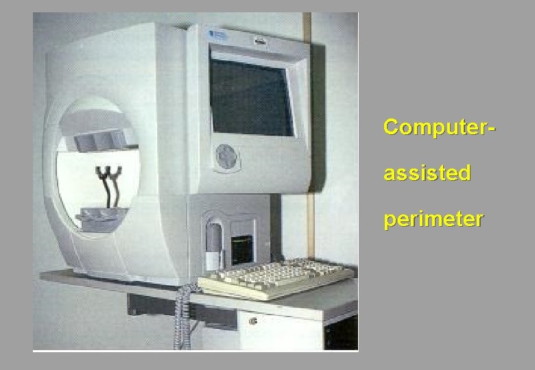 Computerassisted perimeter 