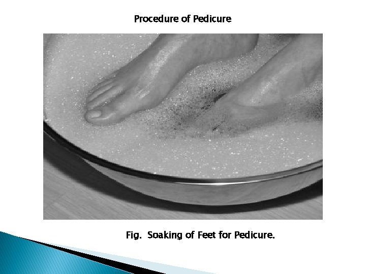 Procedure of Pedicure Fig. Soaking of Feet for Pedicure. 