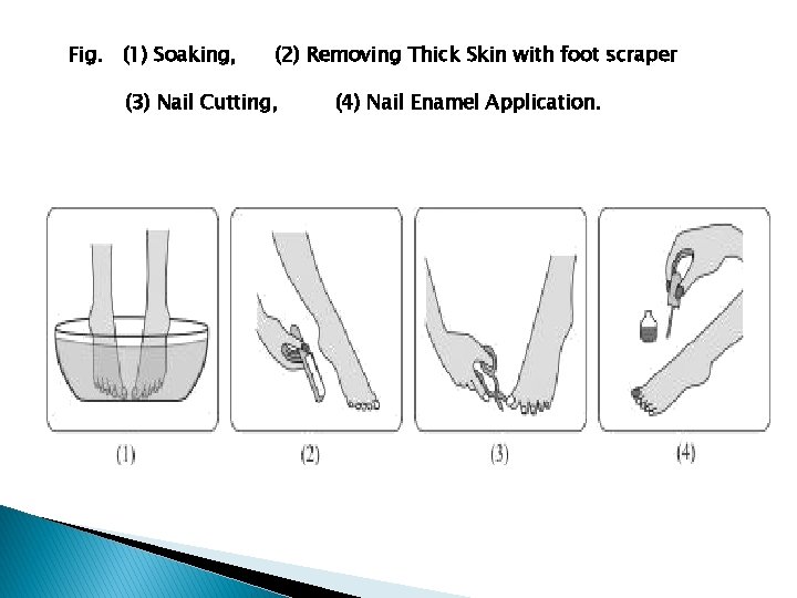Fig. (1) Soaking, (2) Removing Thick Skin with foot scraper (3) Nail Cutting, (4)