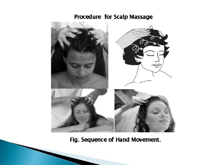 Procedure for Scalp Massage Fig. Sequence of Hand Movement. 