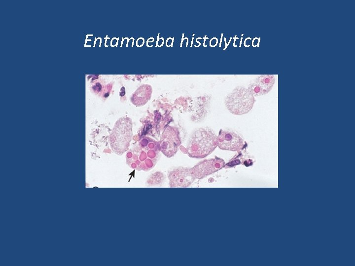 Entamoeba histolytica 