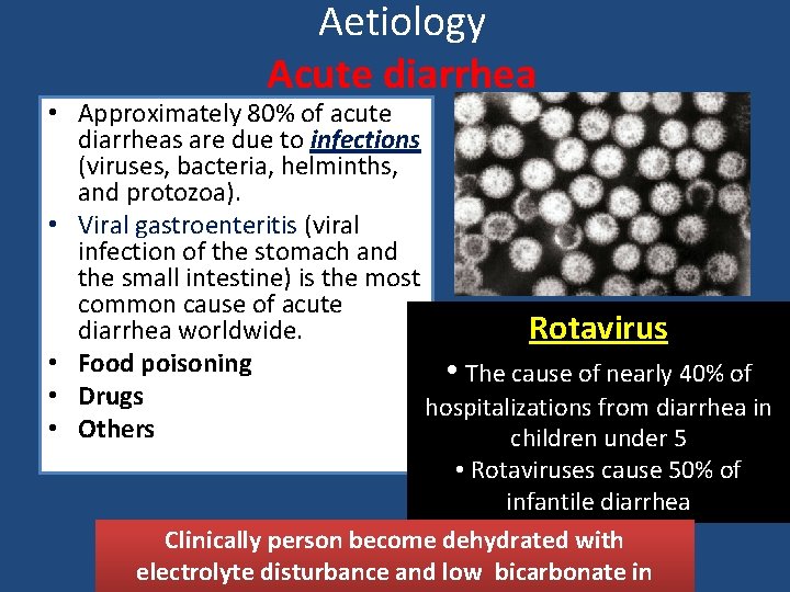 Aetiology Acute diarrhea • Approximately 80% of acute diarrheas are due to infections (viruses,