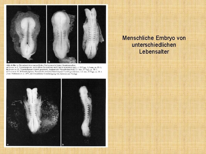 Menschliche Embryo von unterschiedlichen Lebensalter 