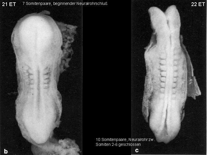 21 ET 7 Somitenpaare, beginnender Neuralrohrschluß 10 Somitenpaare, Neuralrohr zw. Somiten 2 -6 geschlossen