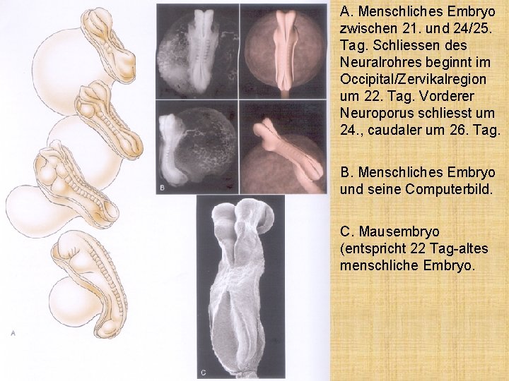 A. Menschliches Embryo zwischen 21. und 24/25. Tag. Schliessen des Neuralrohres beginnt im Occipital/Zervikalregion