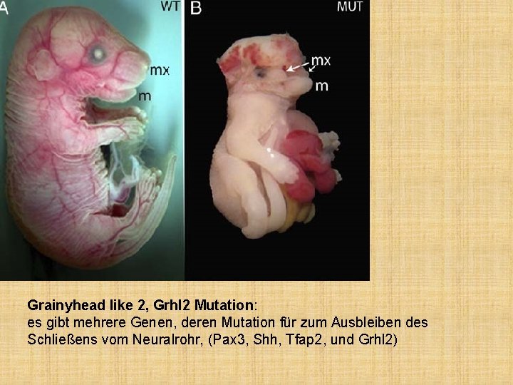 Grainyhead like 2, Grhl 2 Mutation: es gibt mehrere Genen, deren Mutation für zum