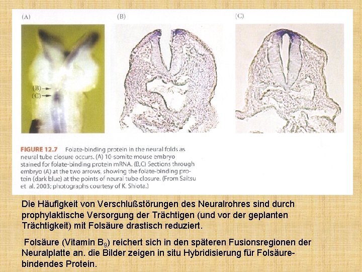 Die Häufigkeit von Verschlußstörungen des Neuralrohres sind durch prophylaktische Versorgung der Trächtigen (und vor