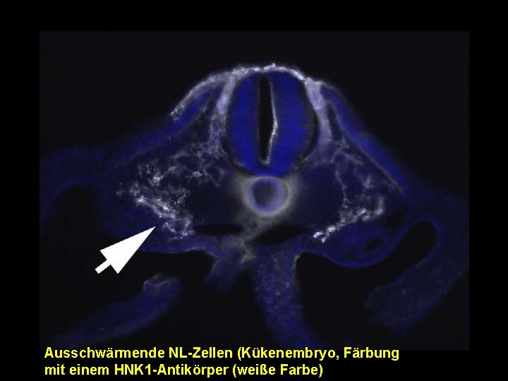 Ausschwärmende NL-Zellen (Kükenembryo, Färbung mit einem HNK 1 -Antikörper (weiße Farbe) 