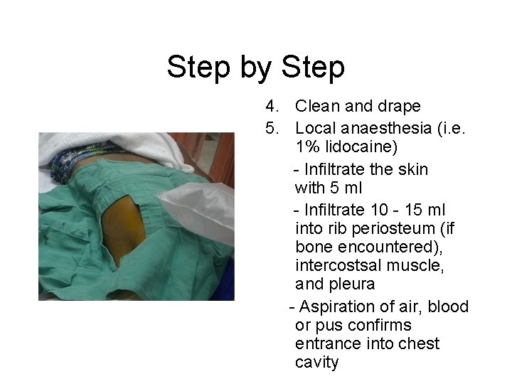Step by Step 4. Clean and drape 5. Local anaesthesia (i. e. 1% lidocaine)