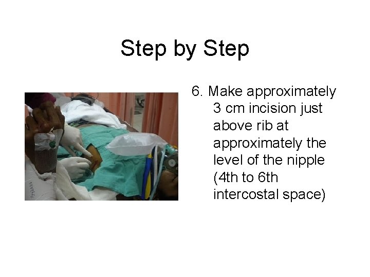 Step by Step 6. Make approximately 3 cm incision just above rib at approximately
