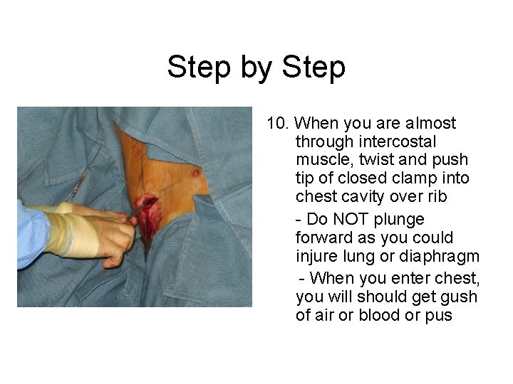 Step by Step 10. When you are almost through intercostal muscle, twist and push