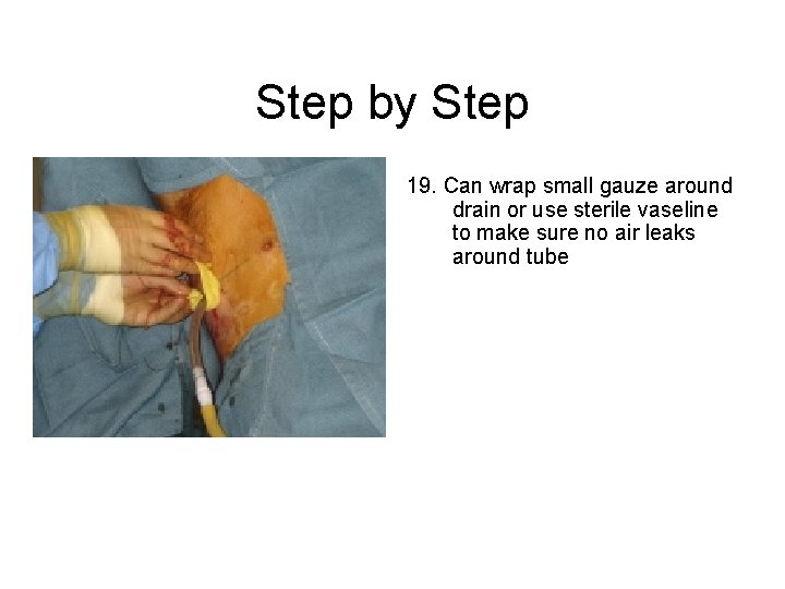 Step by Step 19. Can wrap small gauze around drain or use sterile vaseline