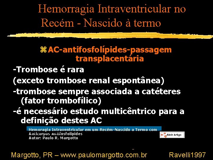 Hemorragia Intraventricular no Recém - Nascido à termo z AC-antifosfolípides-passagem transplacentária -Trombose é rara