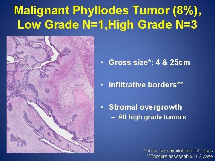 Malignant Phyllodes Tumor (8%), Low Grade N=1, High Grade N=3 • Gross size*: 4