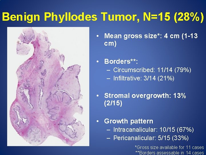 Benign Phyllodes Tumor, N=15 (28%) • Mean gross size*: 4 cm (1 -13 cm)