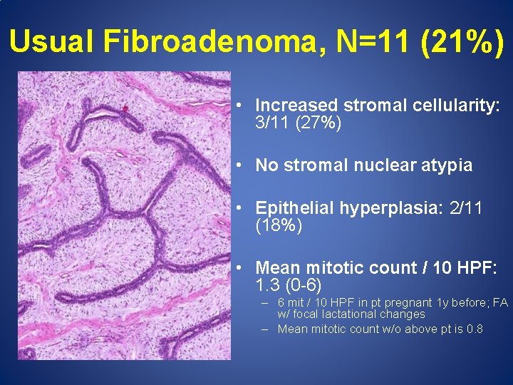 Usual Fibroadenoma, N=11 (21%) • Increased stromal cellularity: 3/11 (27%) • No stromal nuclear
