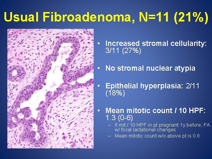 Usual Fibroadenoma, N=11 (21%) • Increased stromal cellularity: 3/11 (27%) • No stromal nuclear