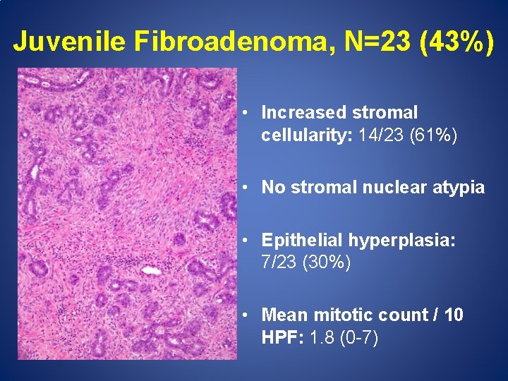 Juvenile Fibroadenoma, N=23 (43%) • Increased stromal cellularity: 14/23 (61%) • No stromal nuclear