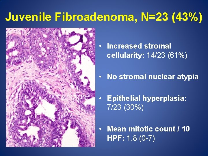 Juvenile Fibroadenoma, N=23 (43%) • Increased stromal cellularity: 14/23 (61%) • No stromal nuclear