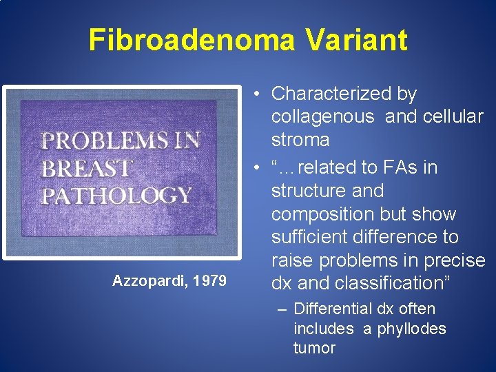 Fibroadenoma Variant Azzopardi, 1979 • Characterized by collagenous and cellular stroma • “…related to