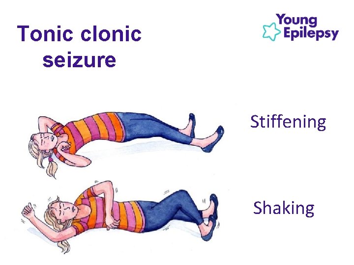 Tonic clonic seizure Stiffening Shaking 