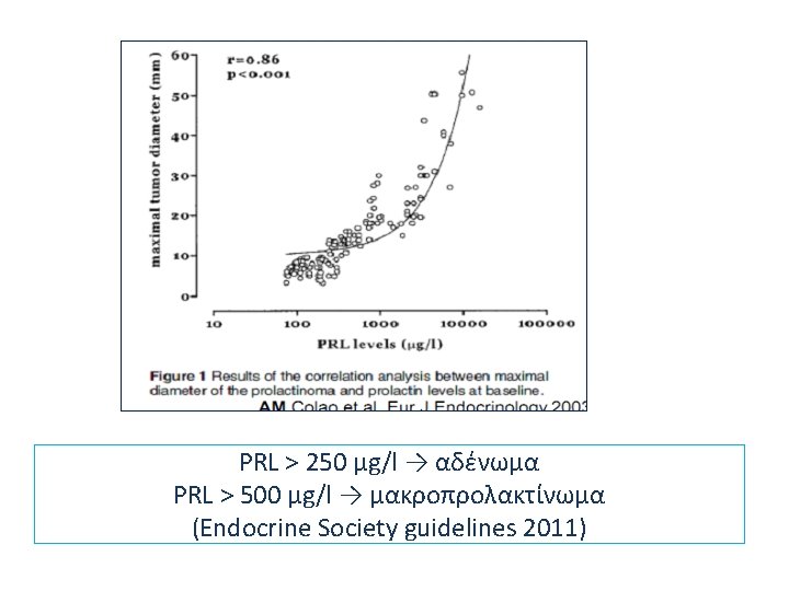PRL > 250 μg/l → αδένωμα PRL > 500 μg/l → μακροπρολακτίνωμα (Endocrine Society