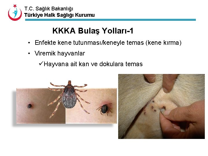 T. C. Sağlık Bakanlığı Türkiye Halk Sağlığı Kurumu KKKA Bulaş Yolları-1 • Enfekte kene