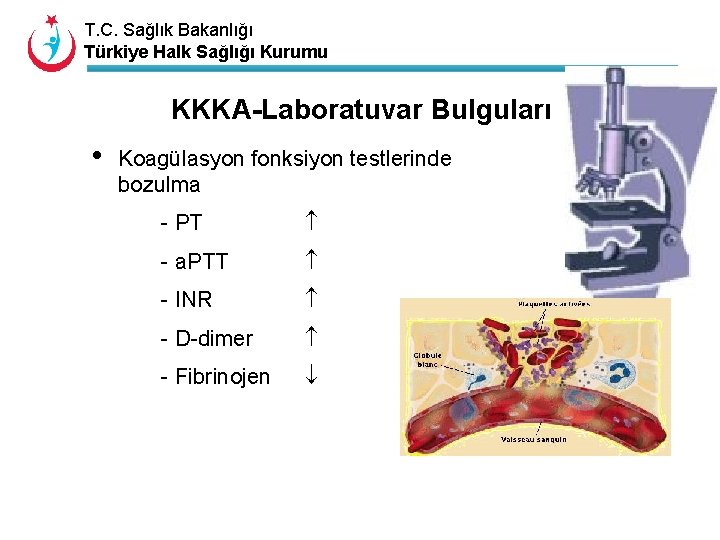 T. C. Sağlık Bakanlığı Türkiye Halk Sağlığı Kurumu KKKA-Laboratuvar Bulguları • Koagülasyon fonksiyon testlerinde
