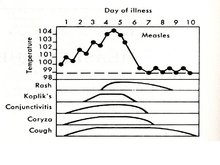 Schematic diagram of clinical course of typical cases of measles. The rash appears 3