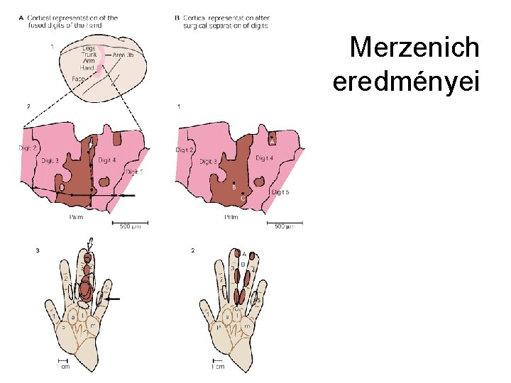 Merzenich eredményei 