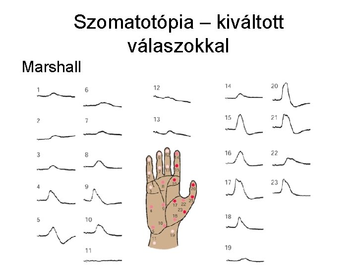 Szomatotópia – kiváltott válaszokkal Marshall 