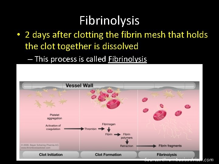 Fibrinolysis • 2 days after clotting the fibrin mesh that holds the clot together
