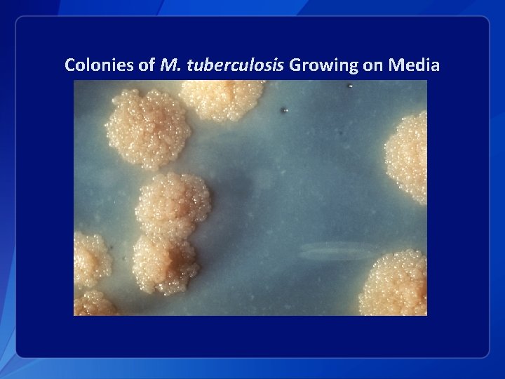 Colonies of M. tuberculosis Growing on Media 