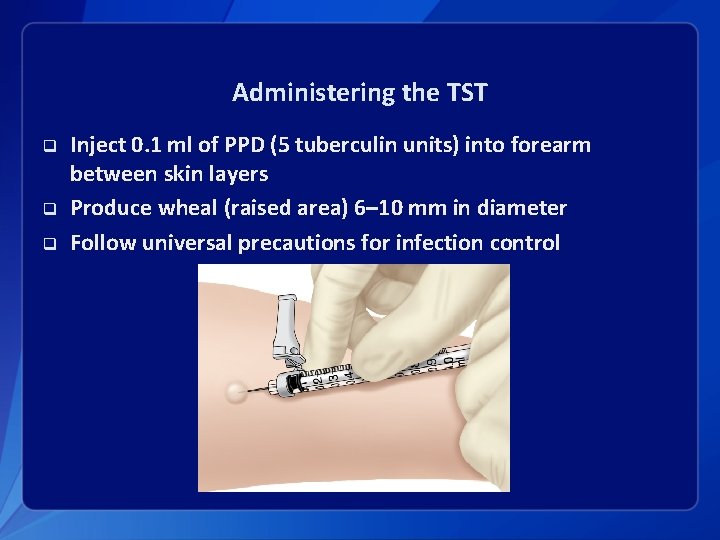 Administering the TST q q q Inject 0. 1 ml of PPD (5 tuberculin