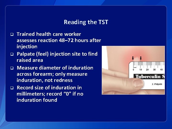 Reading the TST q q Trained health care worker assesses reaction 48– 72 hours