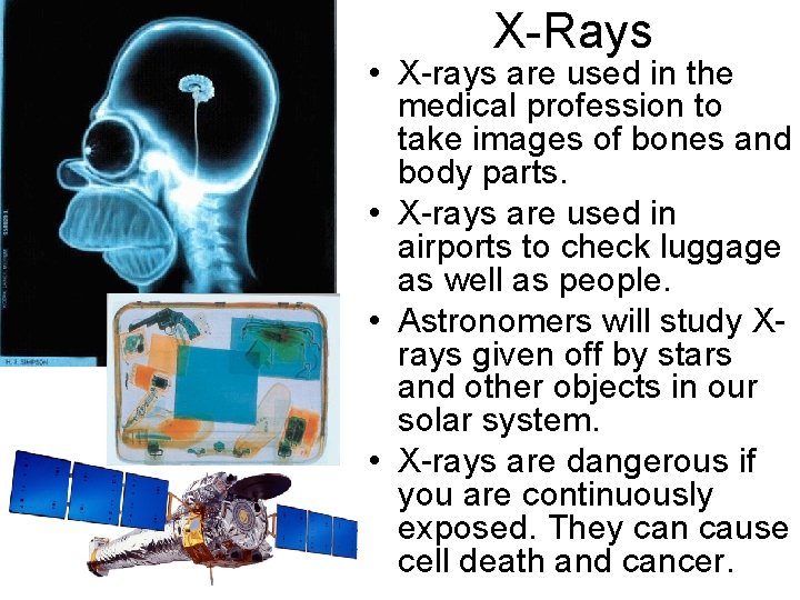 X-Rays • X-rays are used in the medical profession to take images of bones