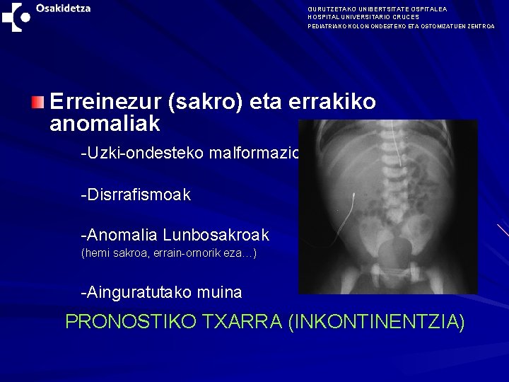 GURUTZETAKO UNIBERTSITATE OSPITALEA HOSPITAL UNIVERSITARIO CRUCES PEDIATRIAKO KOLON-ONDESTEKO ETA OSTOMIZATUEN ZENTROA Erreinezur (sakro) eta