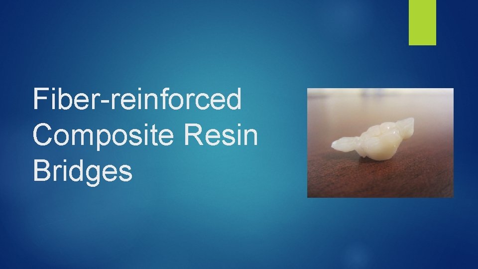 Fiber reinforced Composite Resin Bridges 