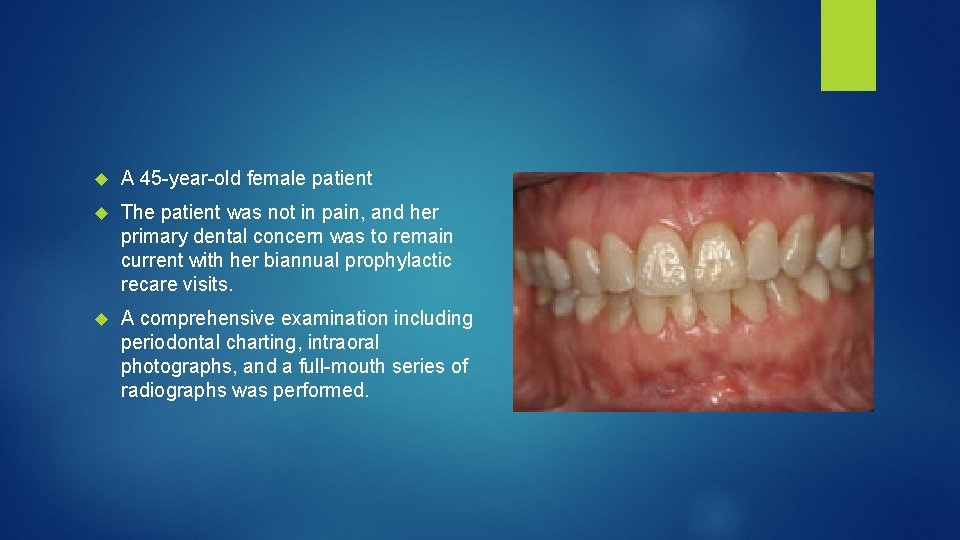  A 45 year old female patient The patient was not in pain, and