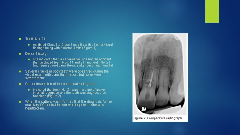  Tooth No. 21 exhibited Class I to Class II mobility with all other