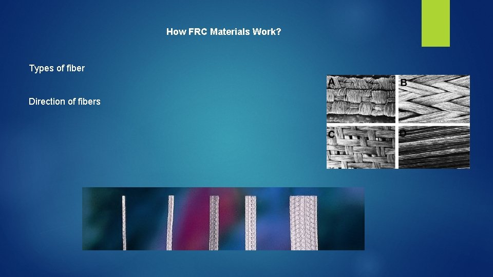 How FRC Materials Work? Types of fiber Direction of fibers 